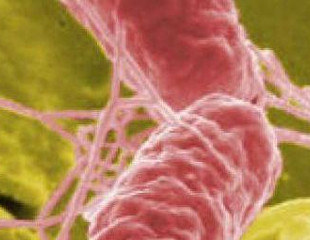 Legionella: in prognosi riservata un 53enne